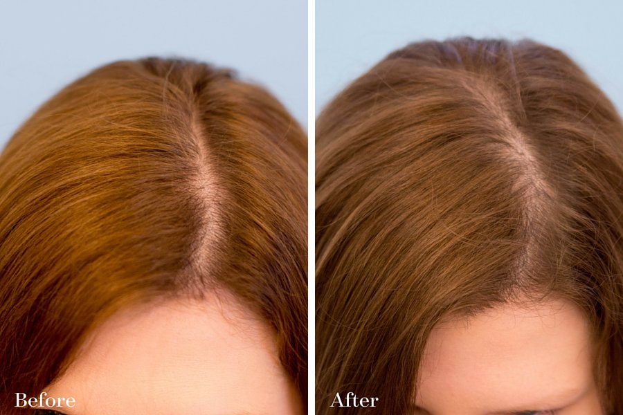 Madison Reed Review: DIY Hair Color That Lasts